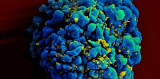 Giornata mondiale contro l’AIDS
