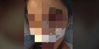 Aggressione in piazza Rossani, il racconto sui social: «La violenza è reale»